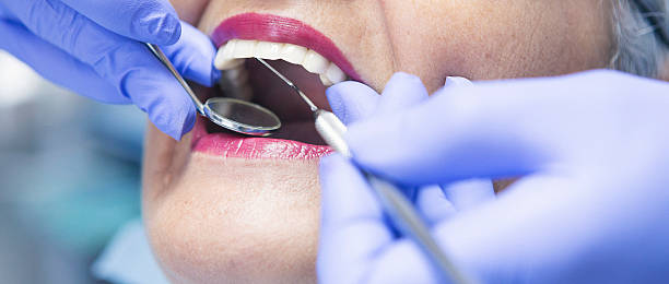 Best Emergency Gum Treatment in Huntsville, TN